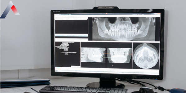 XR_-_Dijital_R__ntgen_Nedir_9b99eb50.png