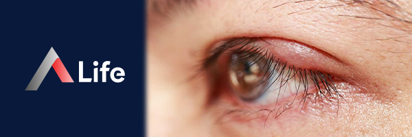 __alazyon_Ameliyat___2650f4f1.webp