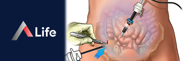 diagnostik_laparotomi_fd693602.webp