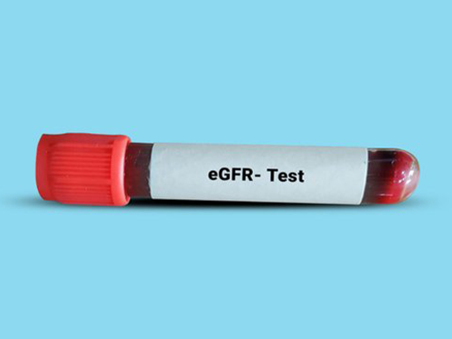 eGFR_Nedir_4592a4cd.webp