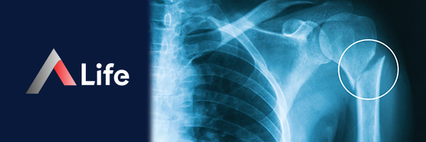 humerus___st_u___k__r__________54606056.webp