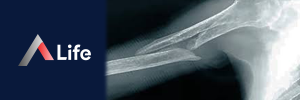 humerus_k__r__________f23338fd.webp