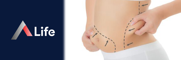 kar__n_liposuction____1c8752d3.webp