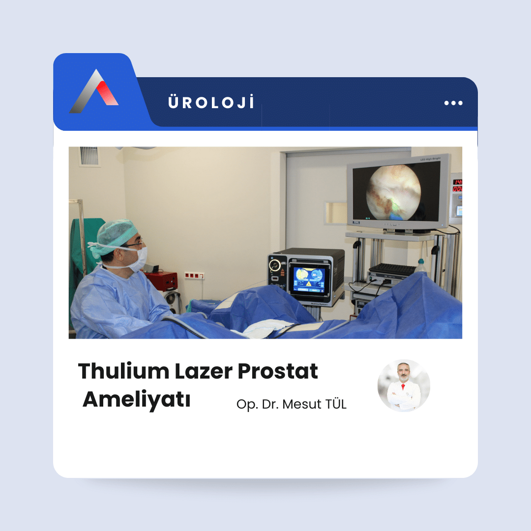 Thulium Lazer Prostat Ameliyatı